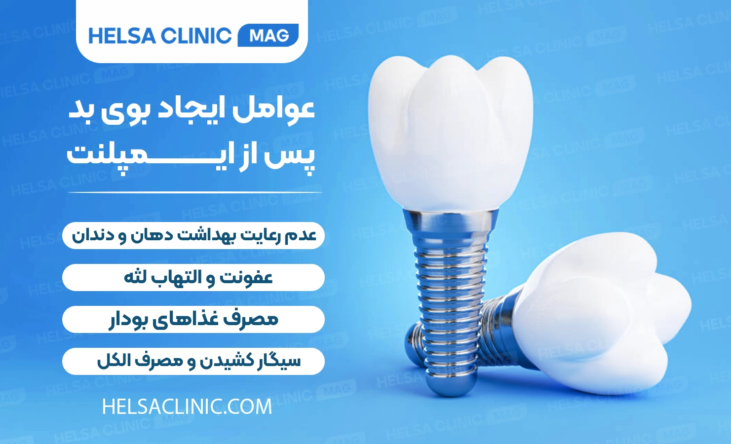 اینفوگرافیک عوامل ایجاد بوی بد دهان پس از ایمپلنت اختصاصی وبسایت دندانپزشکی هلسا